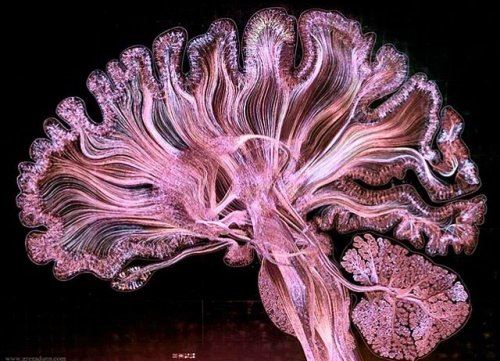 11 рентгеновских снимков и сканов, которые расскажу о человеческом организме интереснее, чем в учебниках