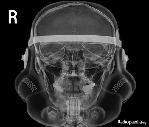 11 рентгеновских снимков и сканов, которые расскажу о человеческом организме интереснее, чем в учебниках